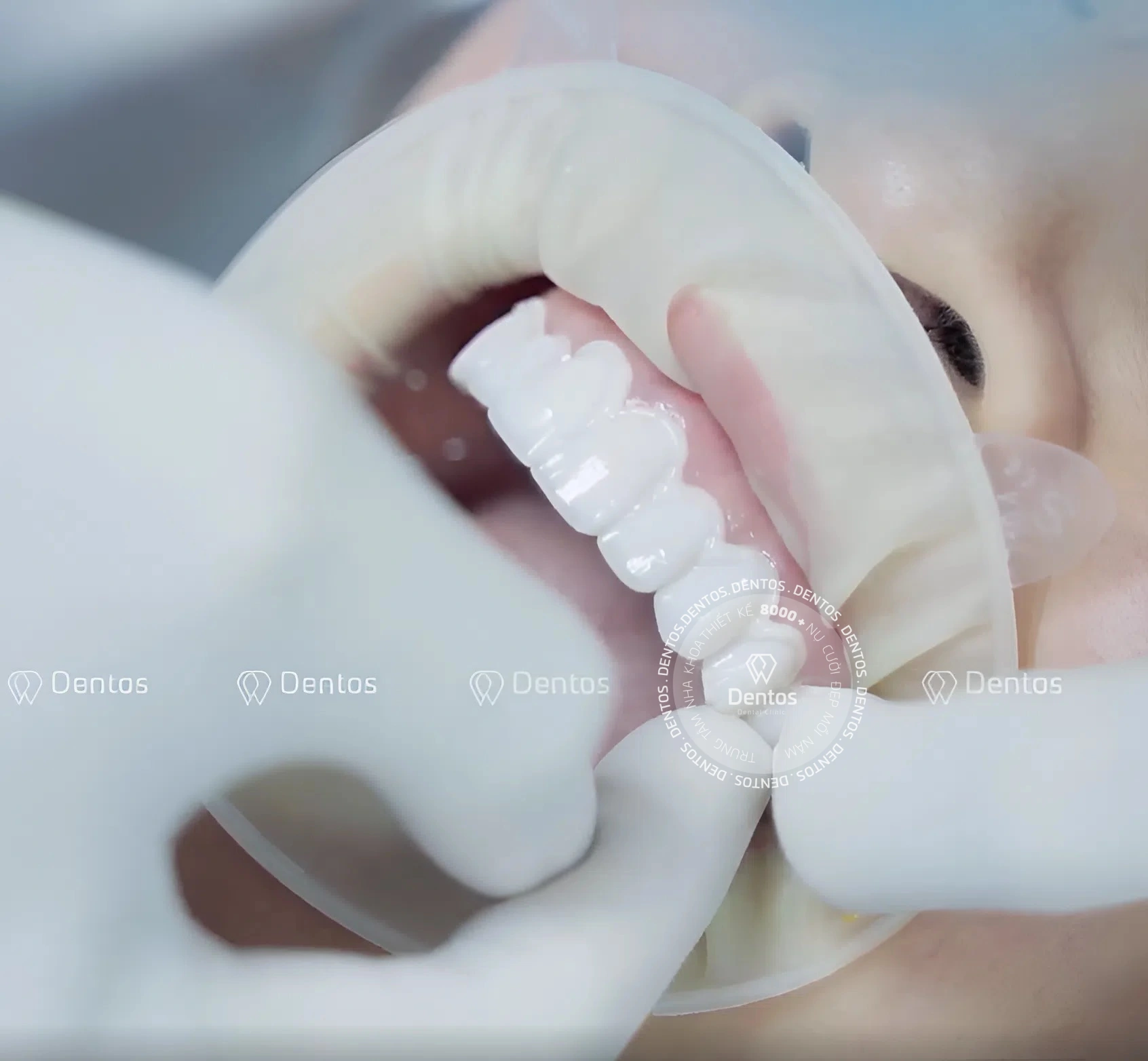 Quá trình dán Veneer gắn kết chặt chẽ khó có thể bị rơi